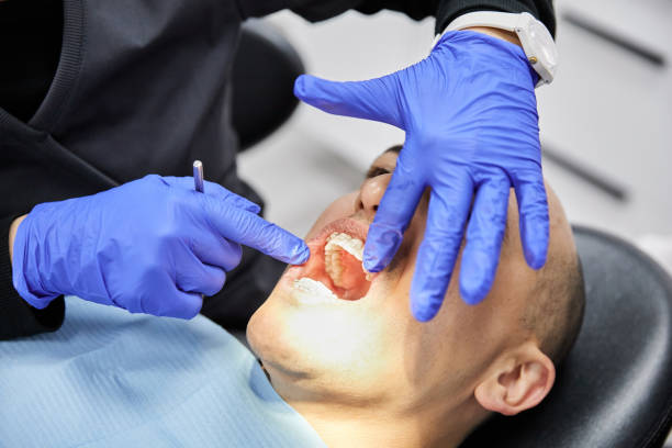 Best Emergency Dentist for Lost Fillings or Crowns in Hasley Nyon, CA